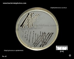 baird parker agar and colony appearance of s.aureus and s.epidermidis